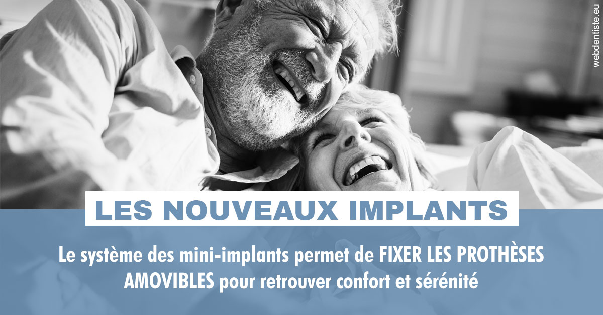 https://www.centredentaireollioules.fr/Les nouveaux implants 2