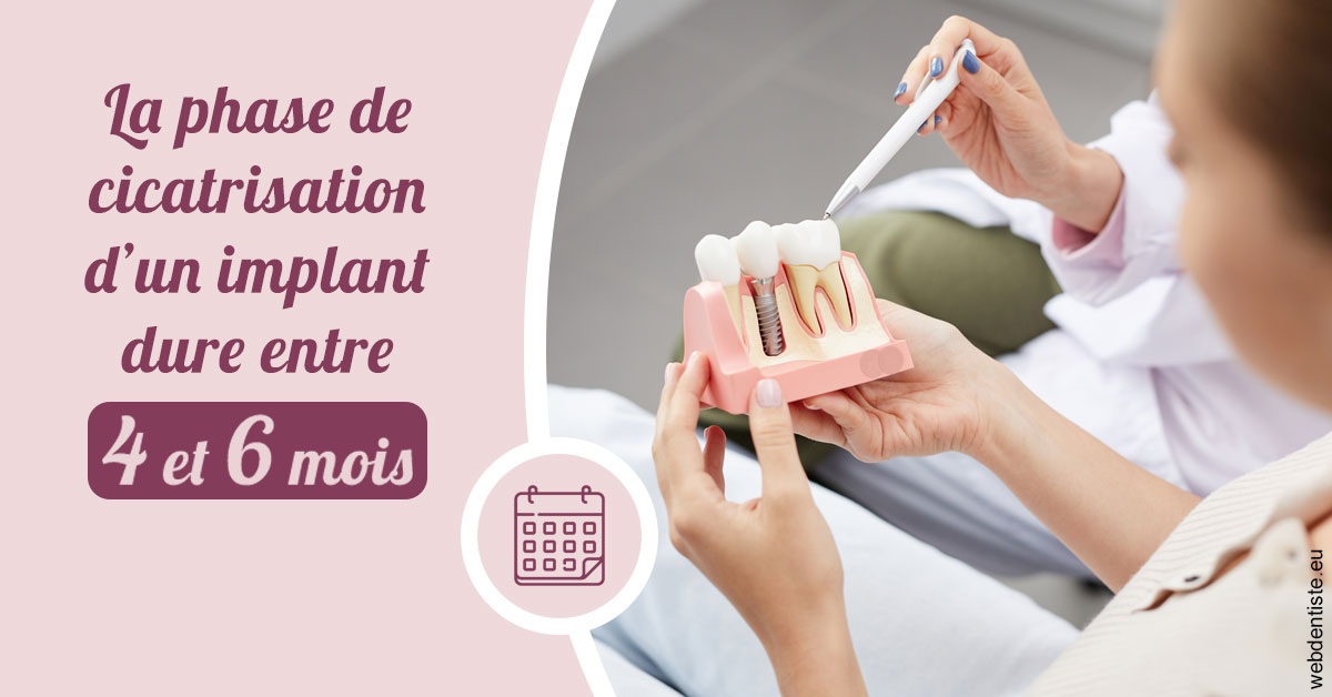 https://www.centredentaireollioules.fr/Cicatrisation implant 2