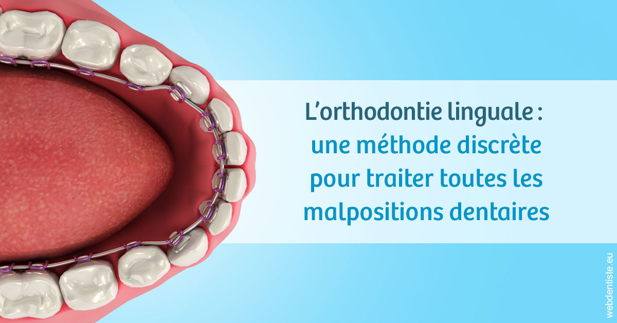 https://www.centredentaireollioules.fr/L'orthodontie linguale 1