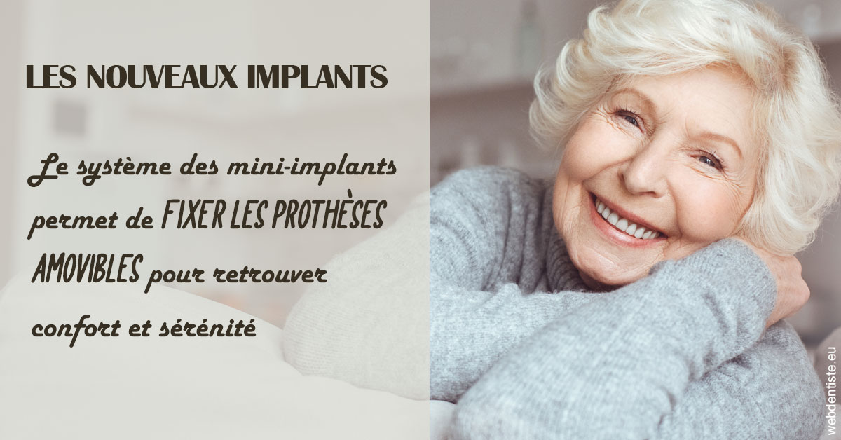 https://www.centredentaireollioules.fr/Les nouveaux implants 1
