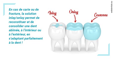 https://www.centredentaireollioules.fr/L'INLAY ou l'ONLAY