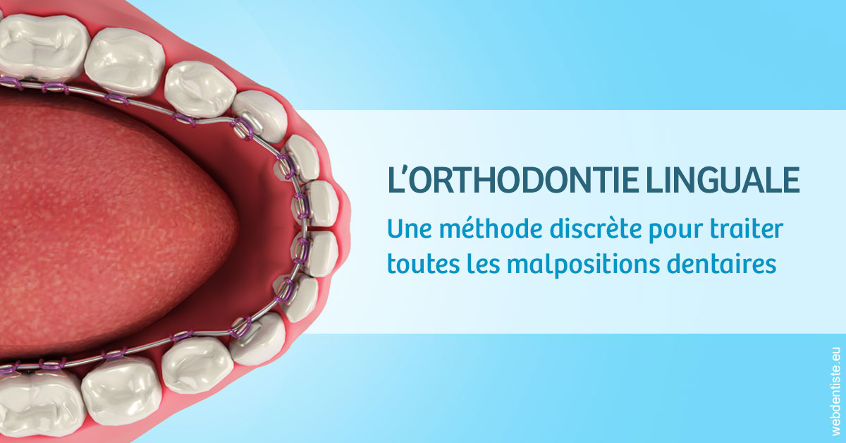 https://www.centredentaireollioules.fr/L'orthodontie linguale 1