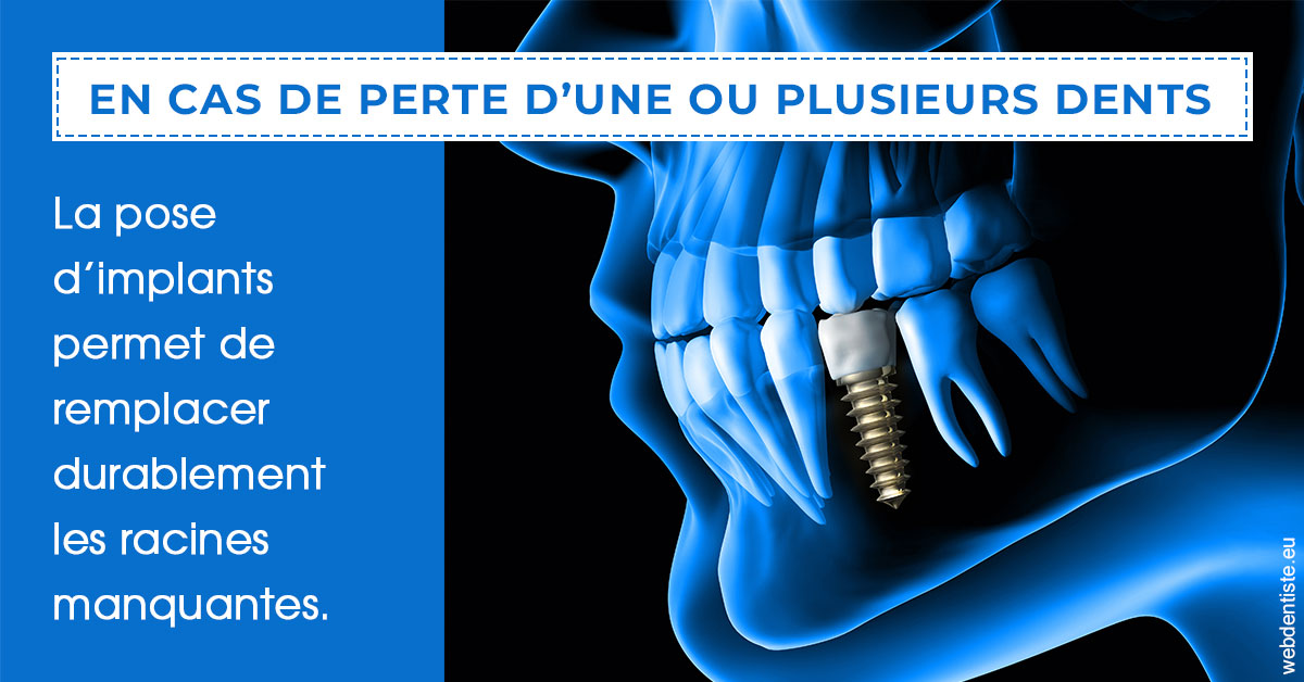https://www.centredentaireollioules.fr/2024 T1 - Implants 01
