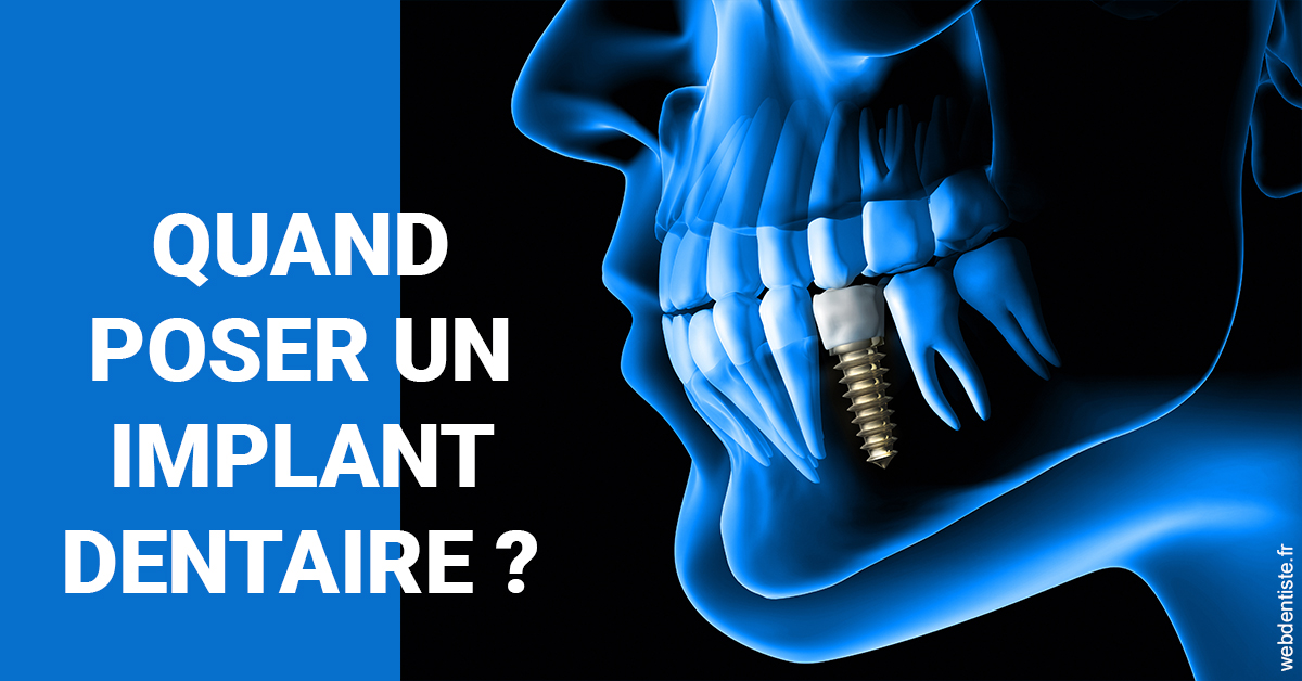 https://www.centredentaireollioules.fr/Les implants 1