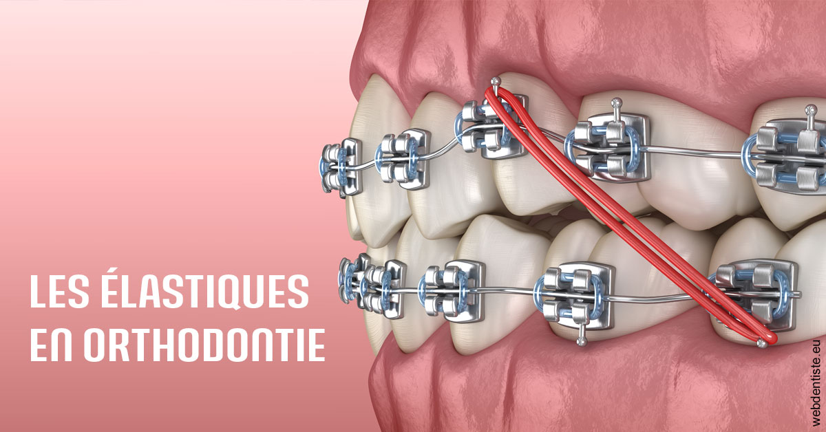 https://www.centredentaireollioules.fr/Elastiques orthodontie 2