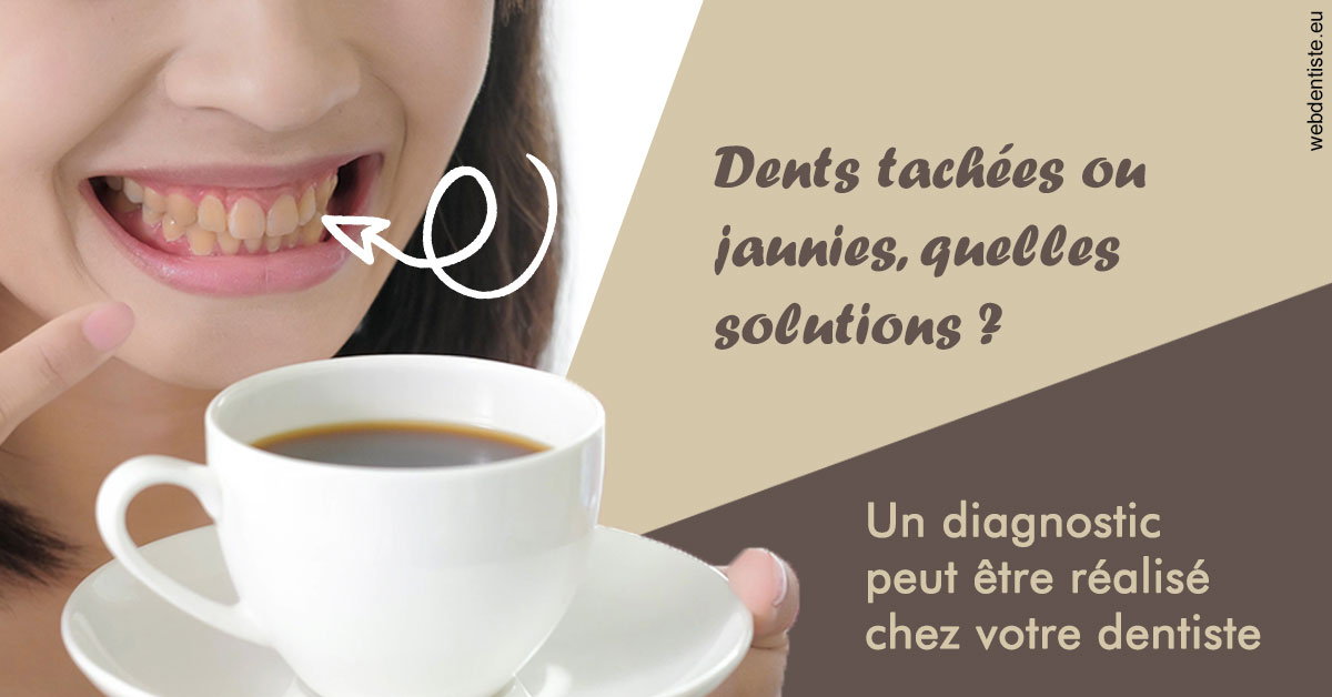 https://www.centredentaireollioules.fr/Dents tachées 1