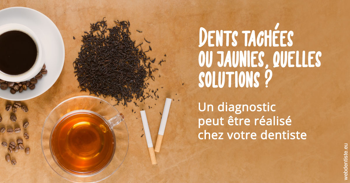 https://www.centredentaireollioules.fr/Dents tachées 2