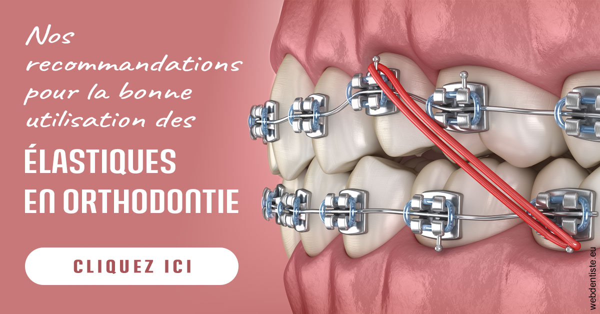 https://www.centredentaireollioules.fr/Elastiques orthodontie 2