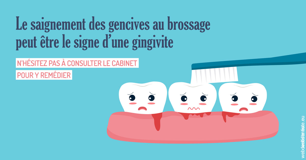 https://www.centredentaireollioules.fr/2023 T4 - Saignement des gencives 02